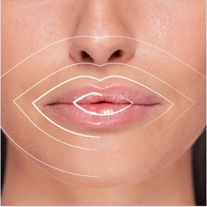 Hyaluronic Lip Volumiser Hyaluronic Lip Volumiser