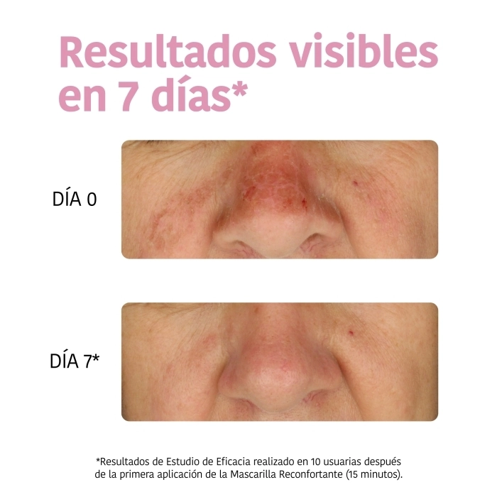 Mascarilla Facial Reconfortante e Hidratante Aloe+Ácido Hialurónico Mascarilla Facial Reconfortante e Hidratante Aloe+Ácido Hialurónico